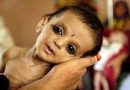 महाराष्ट्र : कुपोषण से पिछले तीन महीने में 2,403 बच्चों की मौत